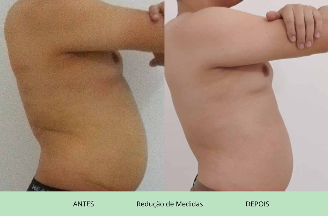 Resultado 4